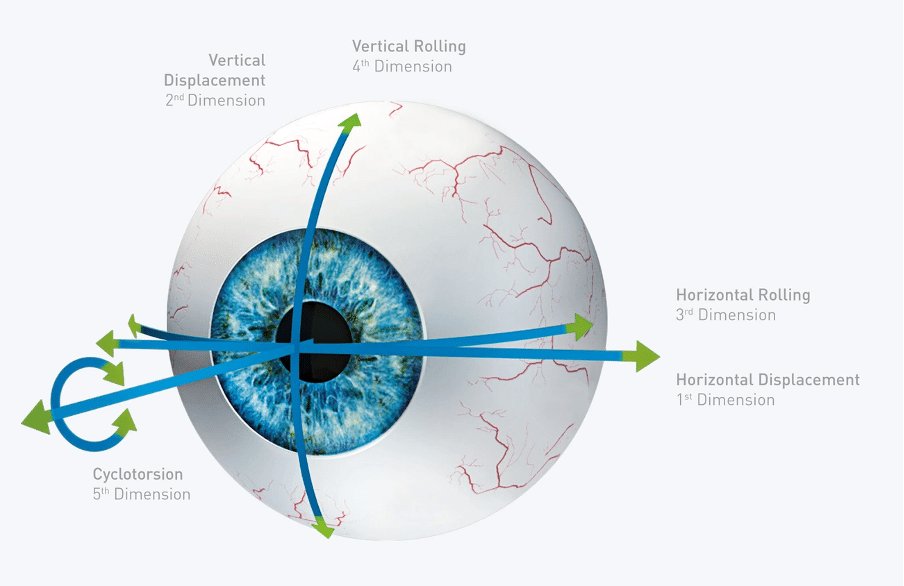 PRK laser eye surgery