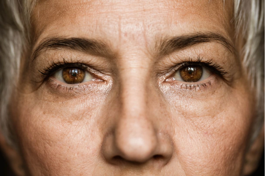 Vision After Cataract Surgery