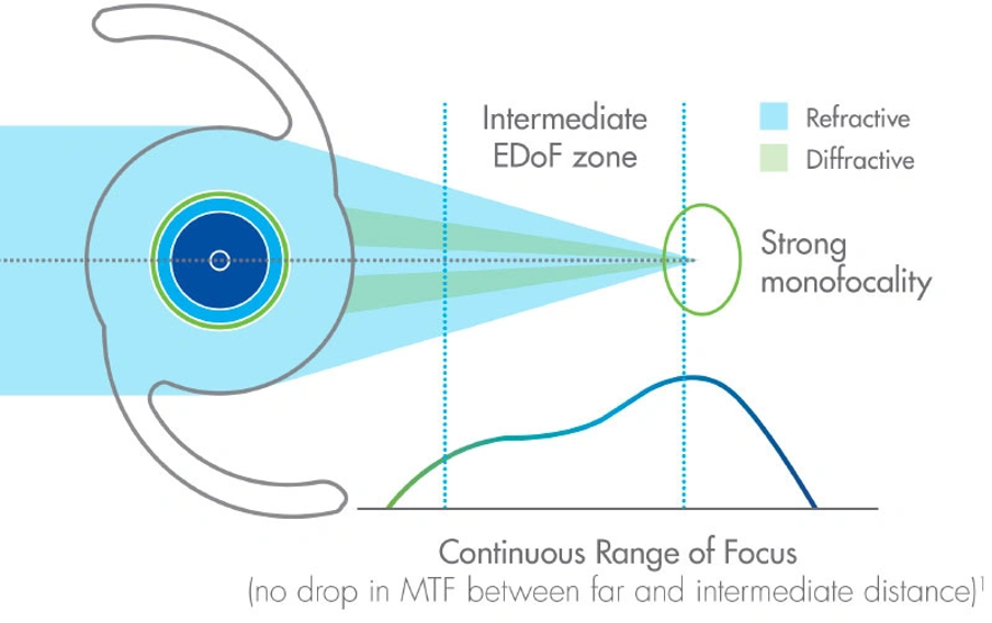 Benefits and Trade-offs of Each Lens Type