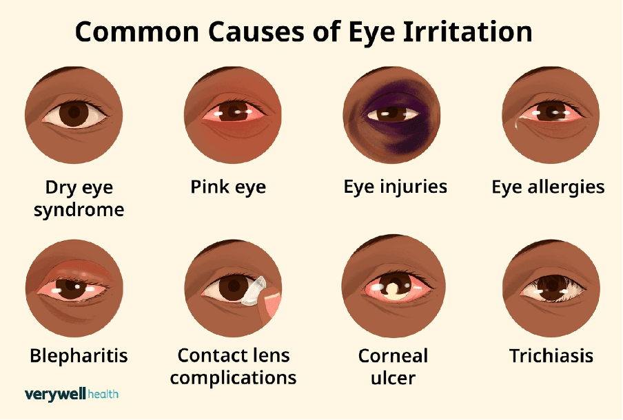 What is Contact Lens Intolerance?