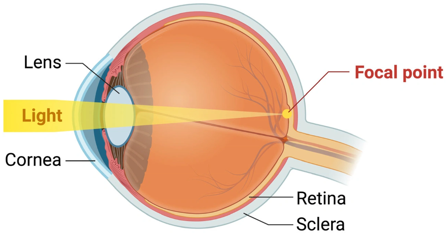 What’s happening inside the eye during early stage cataracts