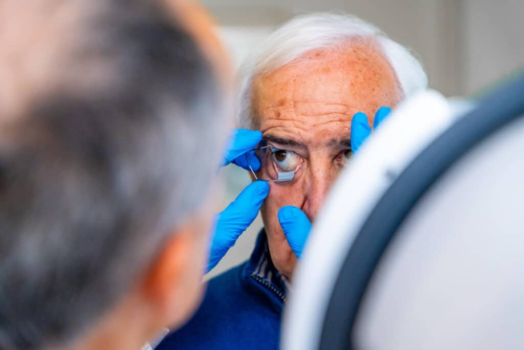 How Long After Cataract Surgery Can You Bend Over