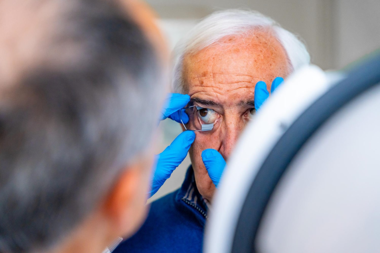 How Long After Cataract Surgery Can You Bend Over
