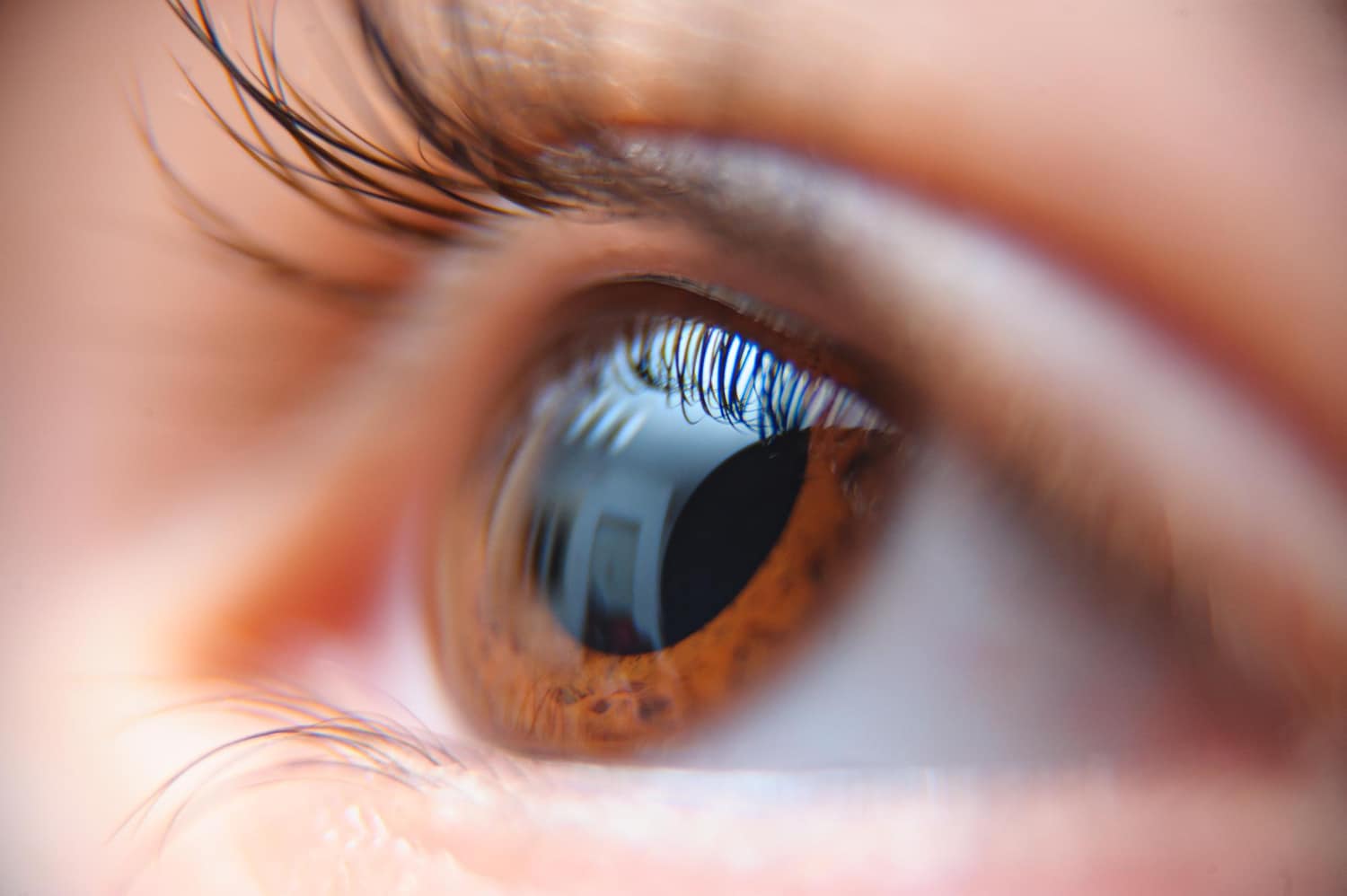 Astigmatism Returns