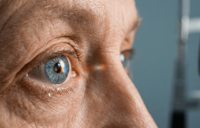 Multifocal Lens in a cataract surgery Multifocal Lens in a cataract surgery