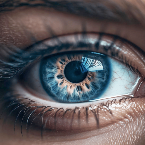 Keratoconus Treatment in London