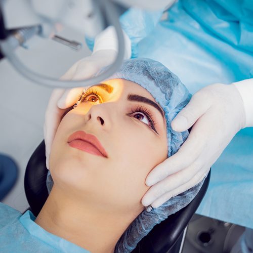 Implantable Contact Lens Surgery